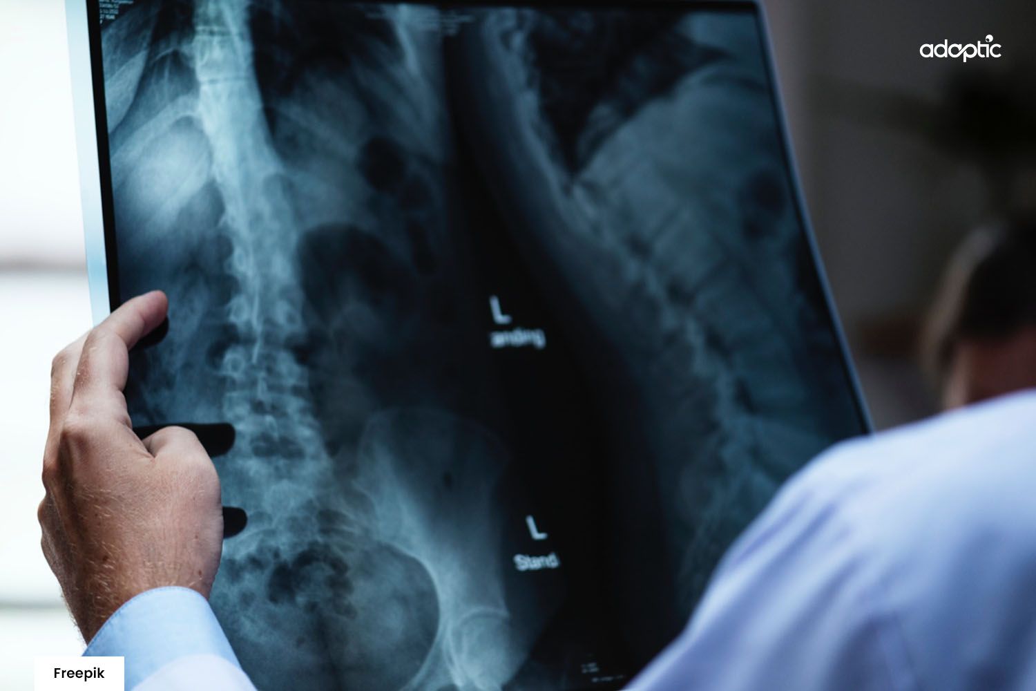 Lekár analyzuje röntgenový snímok chrbtice