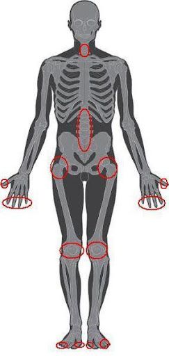 Lidská kostra se zvýrazněnými oblastmi, které postihuje osteoartróza